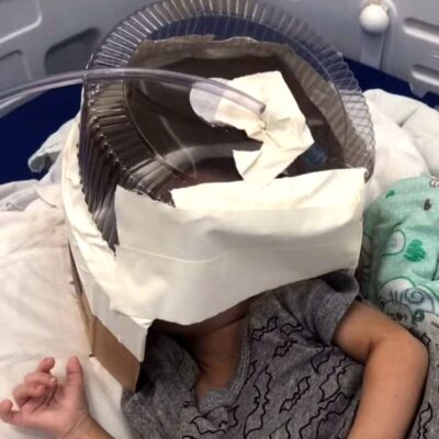 Bebê que precisou de máscara de oxigênio improvisada com embalagem de bolo tem alta da UTI em Natal