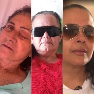 Sobe para 10 número de pacientes que perderam globo ocular após infecção em mutirão de catarata no RN