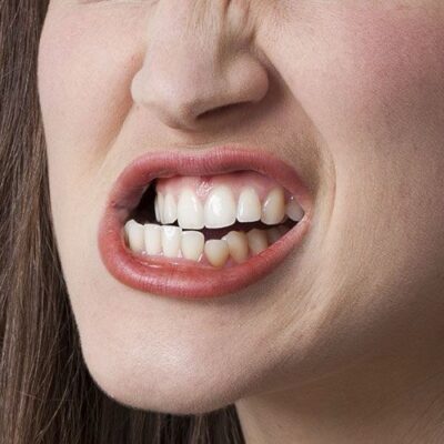 É verdade que o estresse e ansiedade afetam a saúde dos dentes?