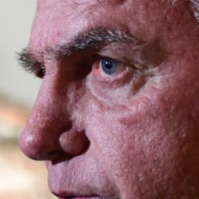 Com crises de soluço, Bolsonaro pede ao STF para deixar prisão domiciliar e passar por exames