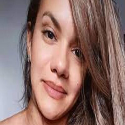 Juliana Soares fará cirurgia no rosto nesta sexta-feira no HUOL