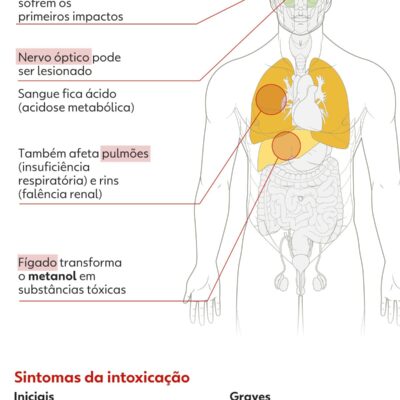 Mulher de 30 anos está em estado grave após ingestão de vodca suspeita no ABC Paulista