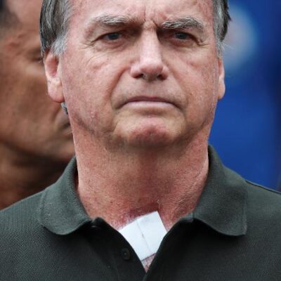 Bolsonaro tem pico de pressão e inicia tratamento para apneia, diz Carlos