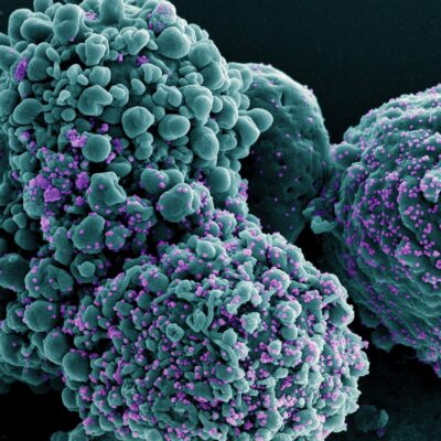 Nova variante da Covid BA.3.2 é confirmada em 23 países com maior escape imunológico