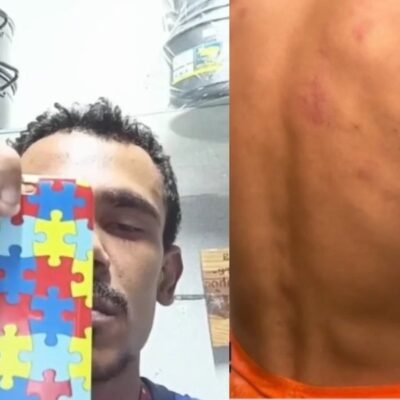 PM do RN afasta policiais após agressão a jovem autista em Macau
