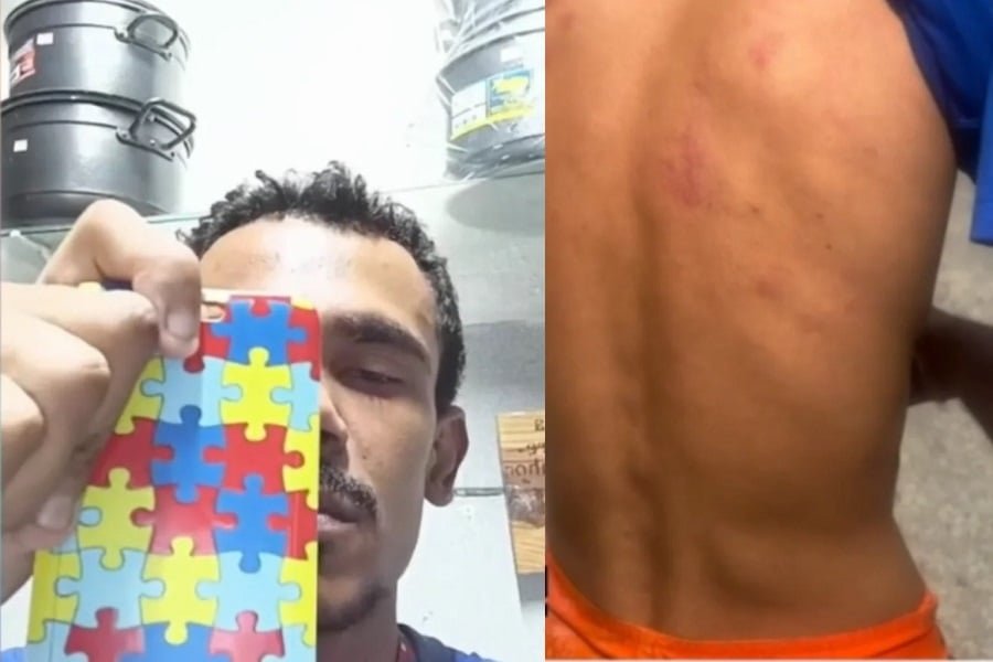 PM do RN afasta policiais após agressão a jovem autista em Macau