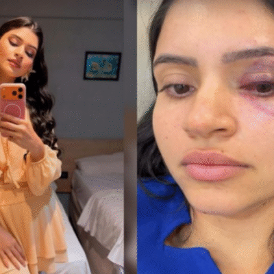Técnica de enfermagem é agredida e sufocada pelo marido em Parnamirim